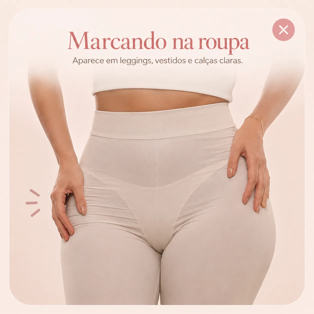 Marcando na roupa — aparece em leggings, vestidos e calças claras.